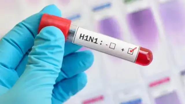 नोएडा में Swine Flu का कहर, मरीजों की संख्या 140 पहुंची
