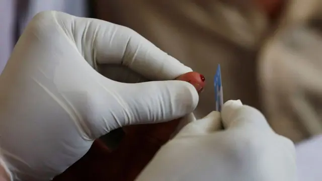 HIV Treatment में नई उम्मीद! 8 हफ्ते वाला इंजेक्शन ज्यादा कारगर, स्टडी में दावा
