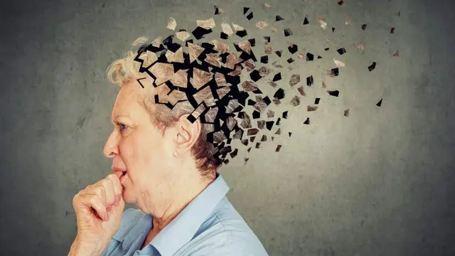 बार-बार चीजें भूलना हो सकता है Alzheimer’s का संकेत, न्यूरोलॉजिस्ट ने दी चेतावनी