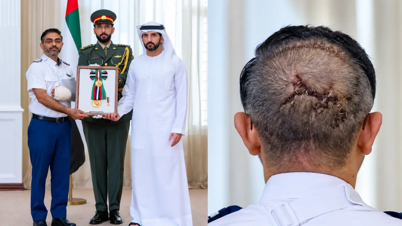 सिर पर लगे टांके बता रहे बहादुरी की कहानी, स्मित मछार को UAE ने किया सम्मानित