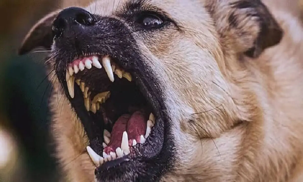 Stray Dog Attack: സഹോദരനുമൊത്ത് കളിച്ചുകൊണ്ടിരുന്ന കുട്ടിയുടെ കൈവിരൽ തെരുവുനായ കടിച്ചെടുത്തു