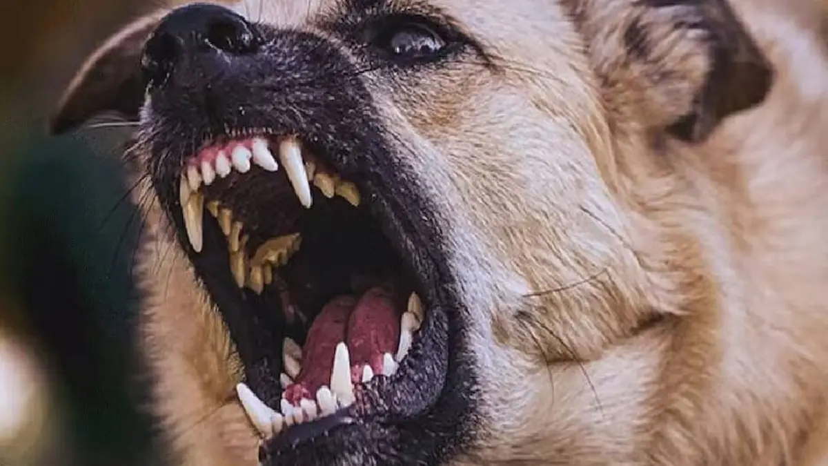 Stray Dog Attack: സഹോദരനുമൊത്ത് കളിച്ചുകൊണ്ടിരുന്ന കുട്ടിയുടെ കൈവിരൽ തെരുവുനായ കടിച്ചെടുത്തു