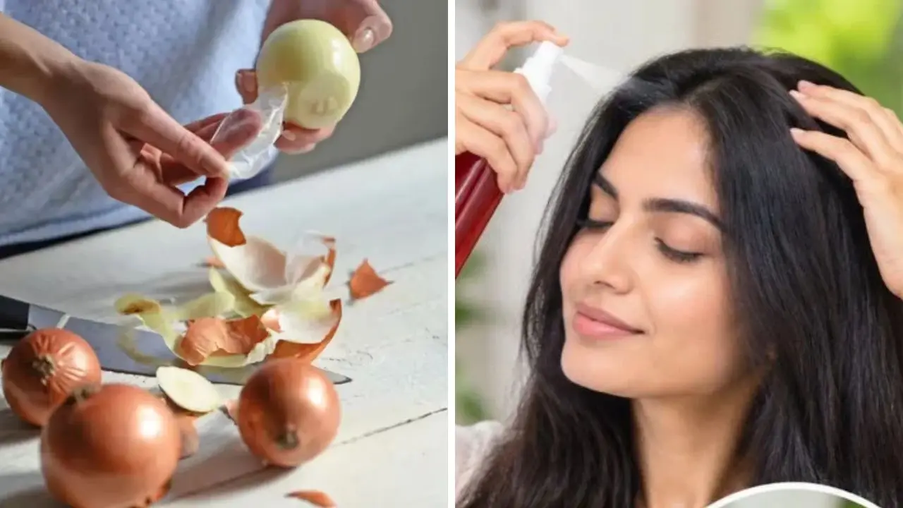 Onion Peel Hair Toner: സവാളത്തൊലി കളയല്ലേ! മുടി വളരാൻ വീട്ടിൽ തന്നെ തയാറാക്കാം ഹെയർ ടോണർ