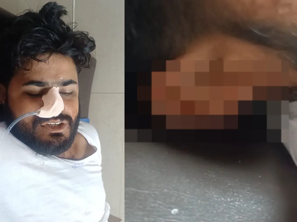 Jodhpur News: युवक के कान काटकर साथ ले गए बदमाश, पत्नी से फोन पर बात करना पति को नहीं था मंजूर