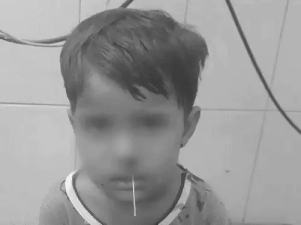 बेटी को सांस लेने में हो रही थी दिक्कत तो मां ने नाक में डाल दी सुई, फिर...