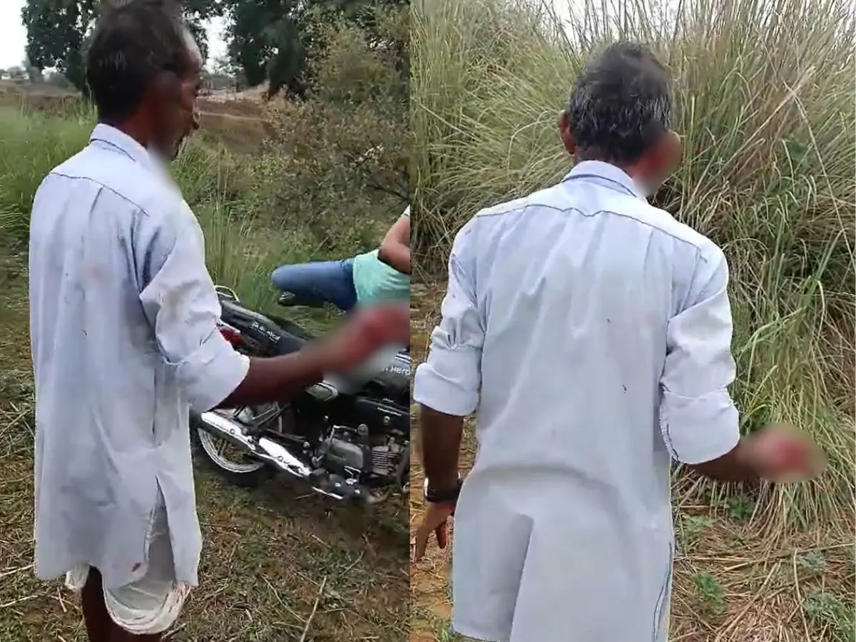घर से खेत में जा रहा था किसान तभी आ गया लेपर्ड, हाथ और कान नोंचकर भागा घर से खेत में जा रहा था किसान तभी आ गया लेपर्ड, हाथ और कान नोंचकर भागा