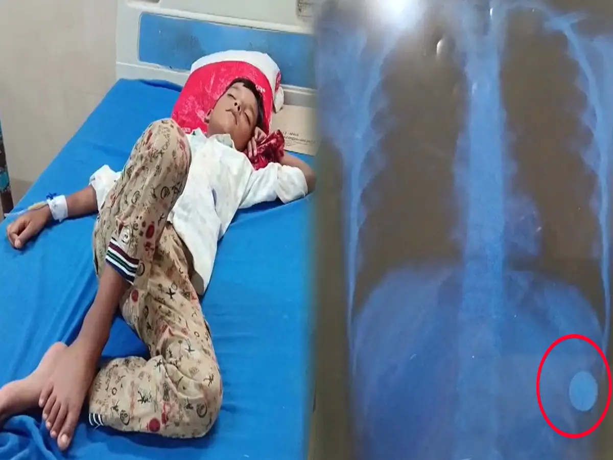 सेल निगल गया 8 साल का बच्चा, AI से पूछता रहा इलाज- पेट में गया सेल कैसे बाहर निकलेगा? सेल निगल गया 8 साल का बच्चा, AI से पूछता रहा इलाज- पेट में गया सेल कैसे बाहर निकलेगा?