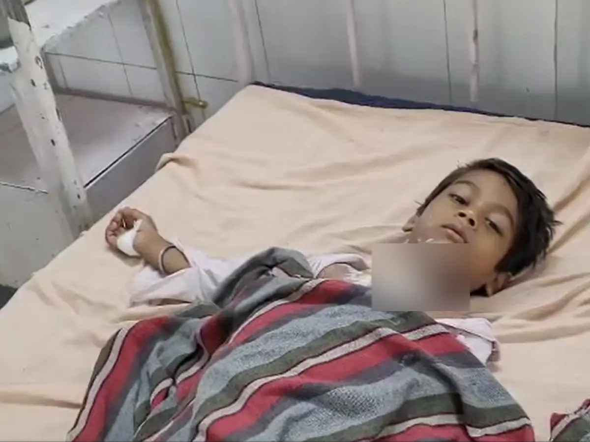 भगोने में गर्म दूध ला रही थी मां, 5 साल का बच्चा दौड़ता आया और हो गया हादसा