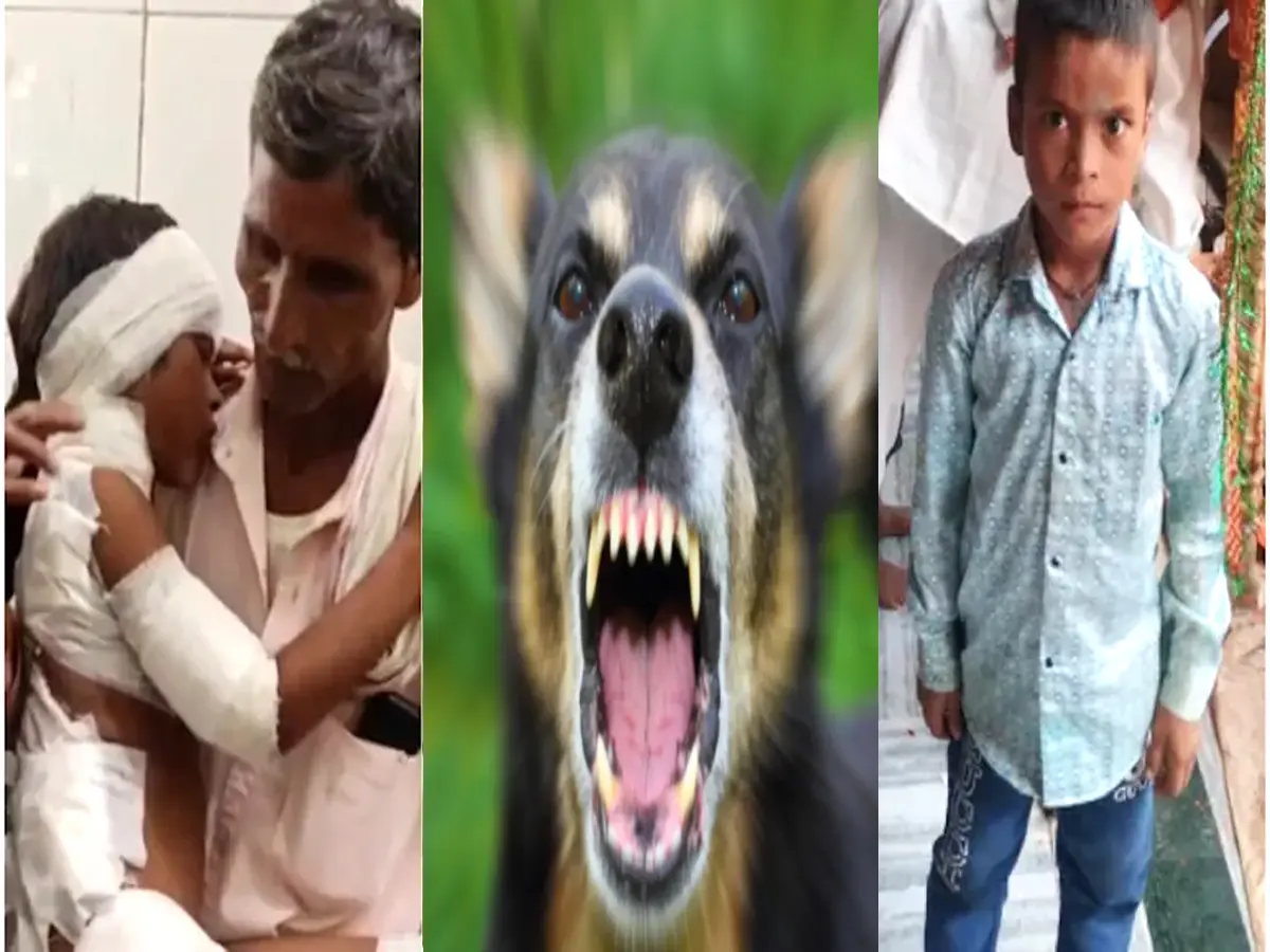 alwar dog attack