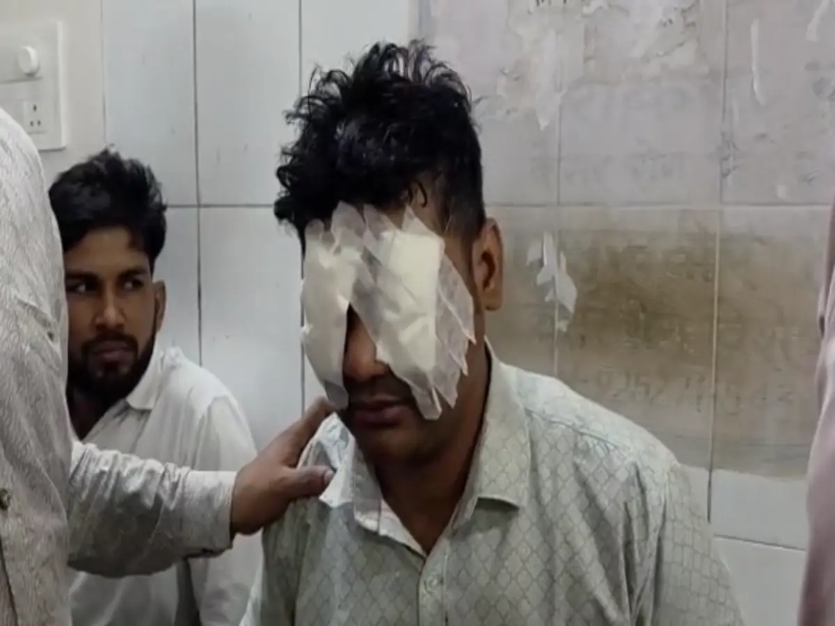 अलवर में जन्मदिन के दिन अचानक फटा सूतली बम, युवक की झुलसीं दोनों आंखें