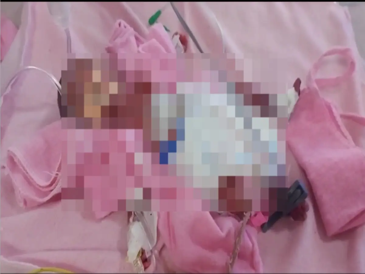 सर्दी में नवजात को खुले में छोड़… मर गयी ममता! भीलवाड़ा के MGH अस्पताल में 600 ग्राम की मासूम जिंदगी से लड़ रही जंग