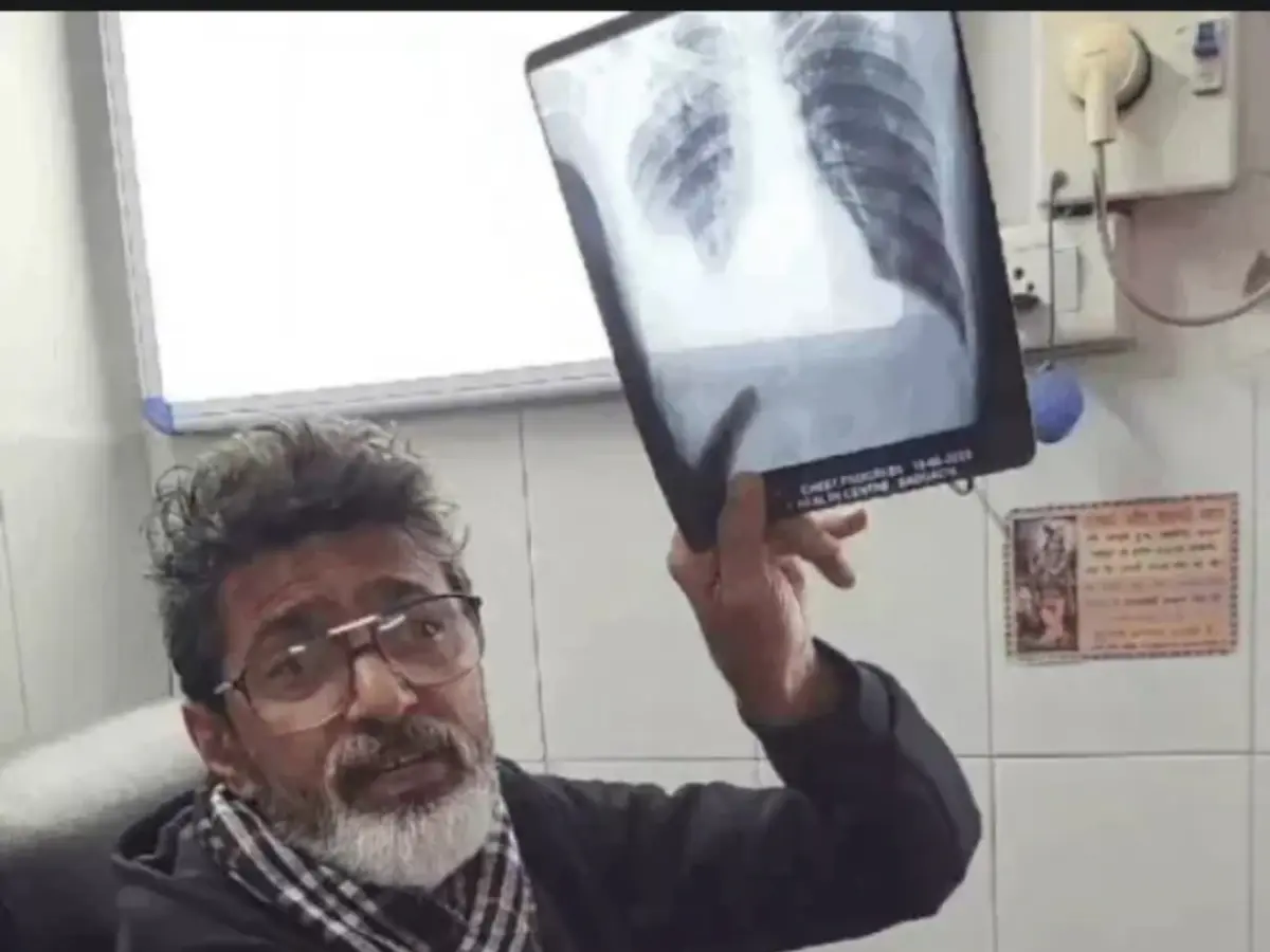 इलाज के बीच रील बनाने पर बड़ा एक्शन, CMHO ने डॉक्टर साहब को किया APO, बोले लापरवाही बर्दाश्त नहीं