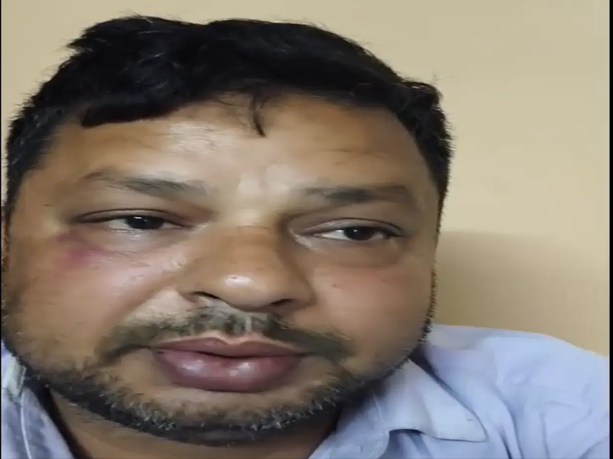 चाकू की नोंक पर जयपुर के व्यापारी के साथ लाखों की लूट, मारपीट के बाद देर रात रोड़ पर फेंका