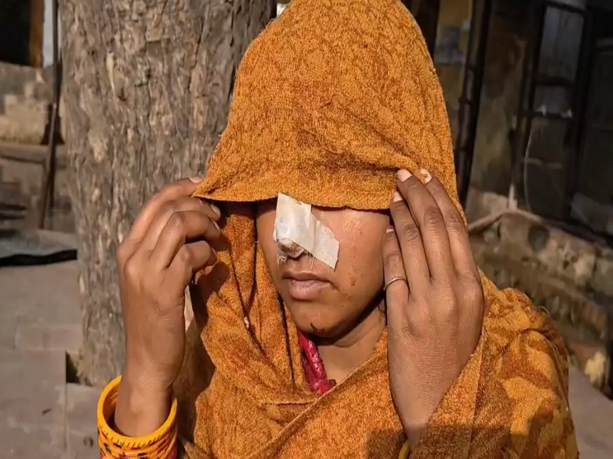 Dholpur News: भाभी ने देवर पर लगाए ये गंभीर आरोप, युवक ने गुस्से में चाकू से काट डाली महिला की नाक