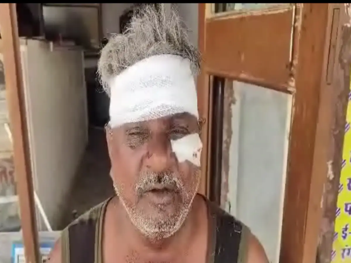 Deedwana News: भतीजे और बहू ने चाचा पर बजाई लाठी-सरिए,  दुकान पर बैठा था शख्स